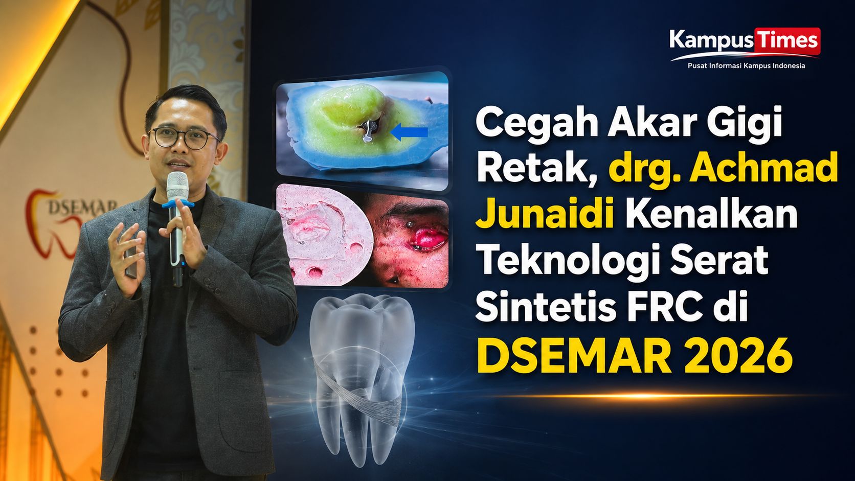 Inovasi Serat Sintetis: Solusi Cegah Akar Gigi Retak